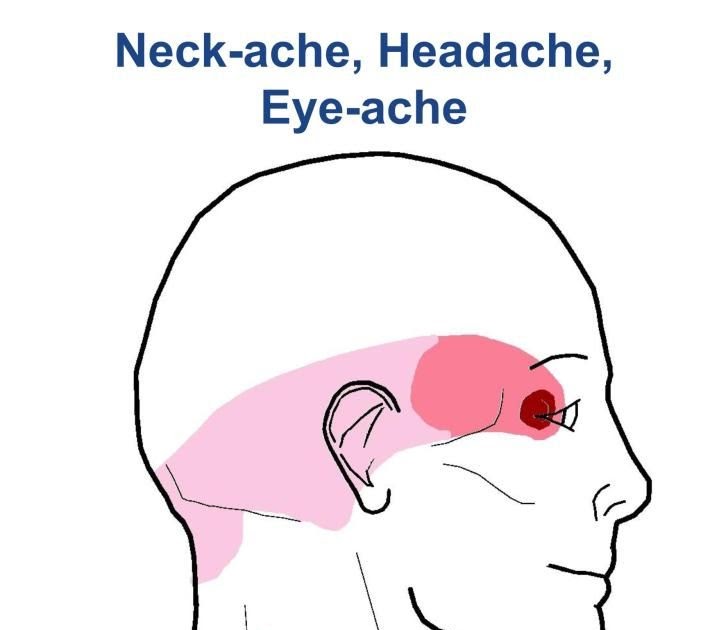 How To Get Rid Of Left Side Temple Headache TOKHOW