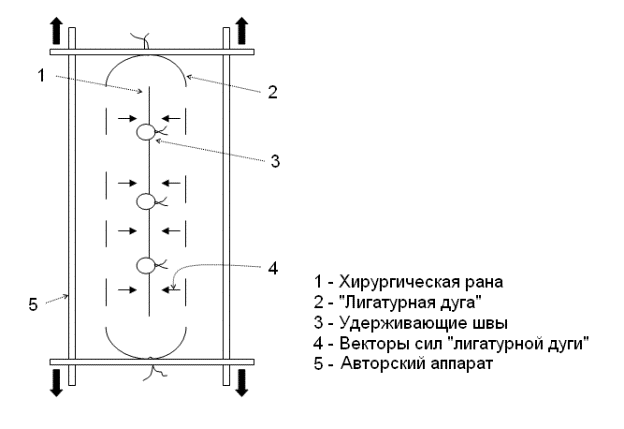 Стадии заживления лунки фото