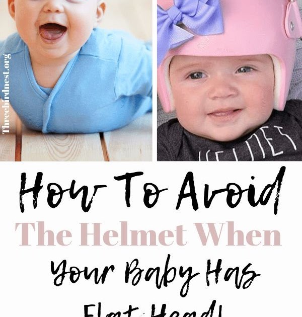 why do some babies wear those helmets Remain The Main