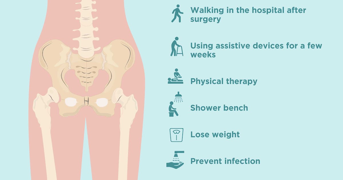 top-mistakes-after-hip-replacement-youtube