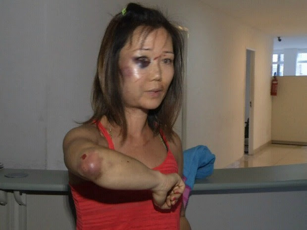 Turista de 39 anos teve ferimentos no rosto e no braço (Foto: TV Diário/Reprodução)
