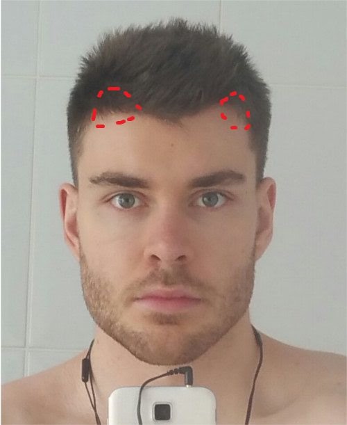 54 How to fix forehead hairline Shoulder Length