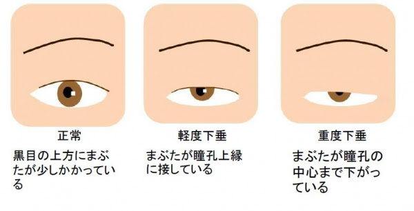 √99以上 眠たそうな目 222199眠たそうな目 イラスト saikonodommuryogazo
