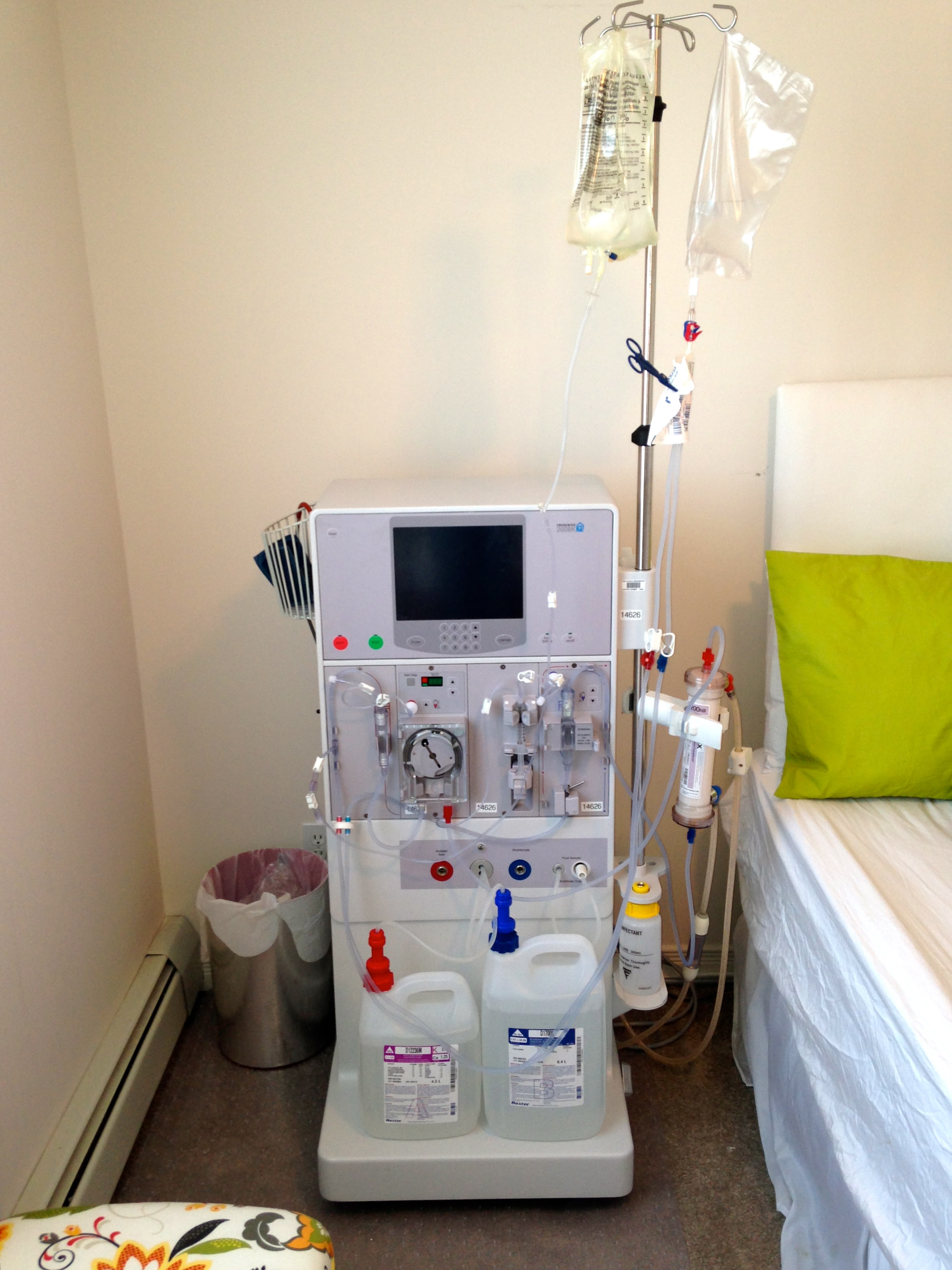 Portable Dialysis machine Fresenius
