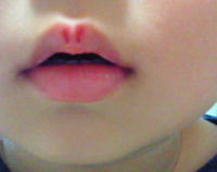 【ベストコレクション】 赤ちゃん 唇 赤い点 265675-赤ちゃん 唇 赤い点