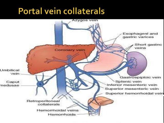 Расширение воротной вены. Внутрипеченочная портальная гипертензия. Портальная гипертензия портокавальные анастомозы. Предпеченочная портальная гипертензия. Портальная гипертензия воротной вены.