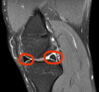 knee1.tiff