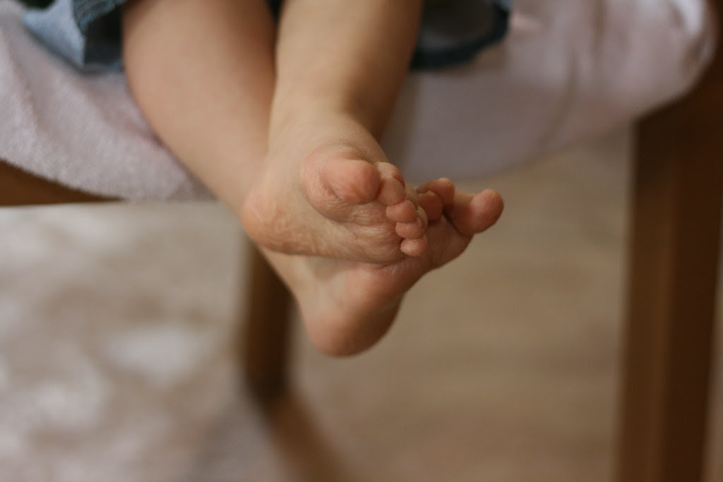 prune toes