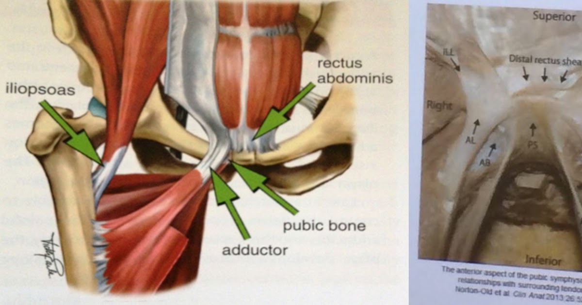 Diagram Of Groin Area Groin Pain Treatment And Terminology By Sam