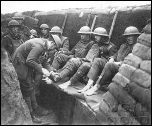WORLD WAR 1 LIFE IN THE TRENCHES: Dangers Soliders Faced in World War One