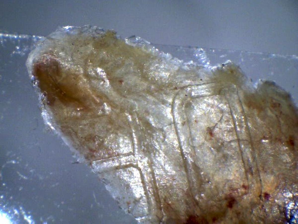 terrapapers.com_Morgellons