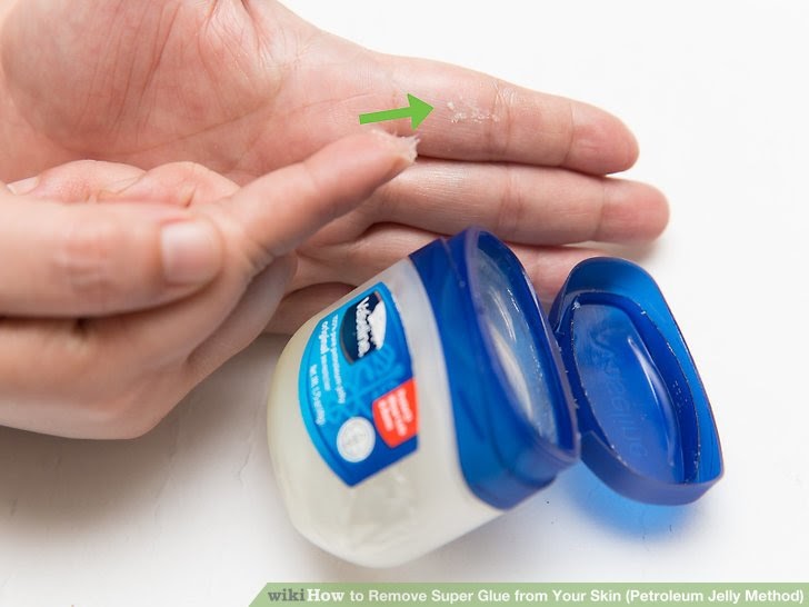 How to get super glue off your teeth teethwalls