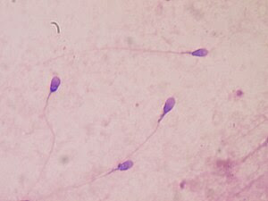 English: Human sperm stained for semen quality...