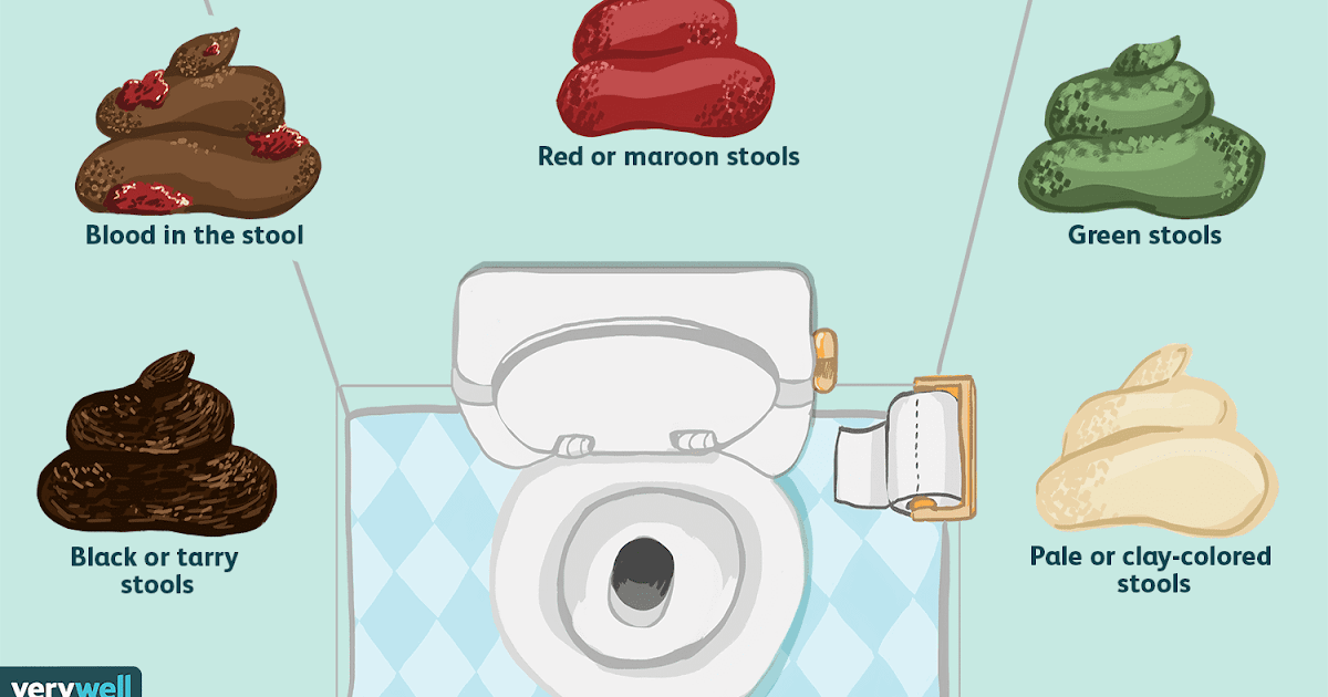 What Does Blood In Stool Look Like Colon Cancer - What Does