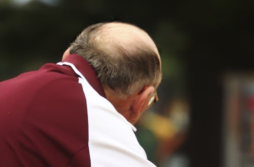 How to Slow Down Hair Loss - Totorus