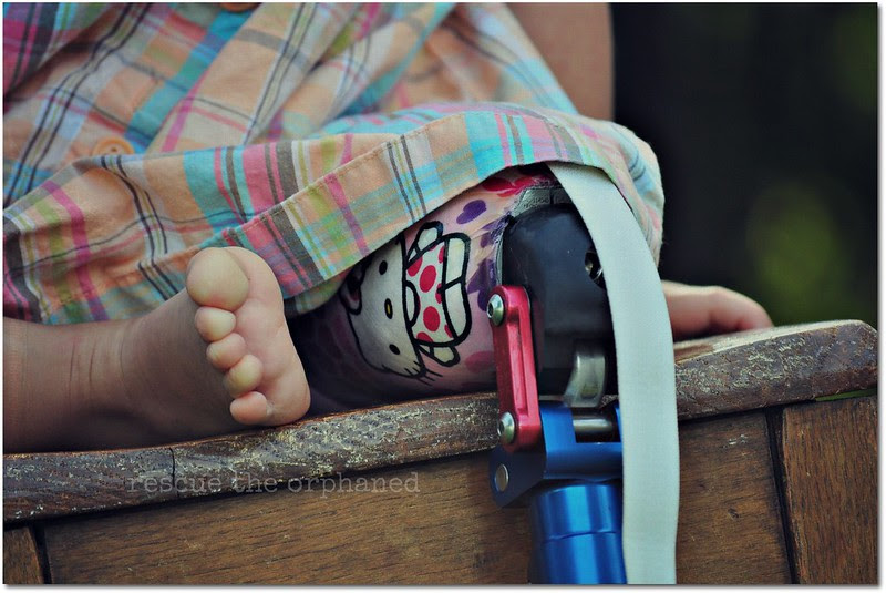 prosthetic2