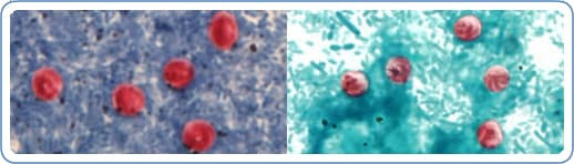 Left: Cryptosporidium sp. oocysts stained with Ziehl-Neelson modified acid-fast. | Right: Cryptosporidium sp. oocysts stained with safranin.