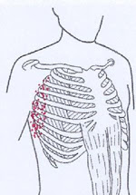 Schmerzen Unterhalb Der Rechten Brust