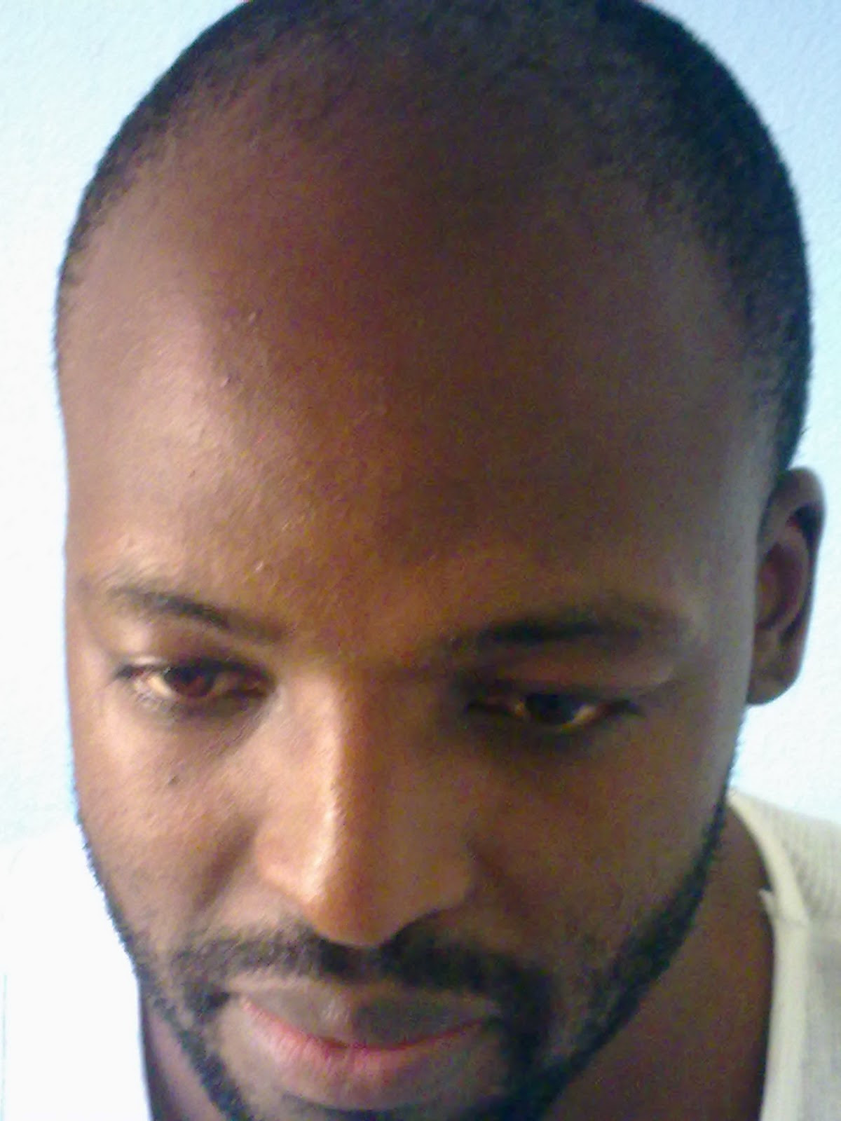 Hairstyle For Far Back Hairline Damen Hair