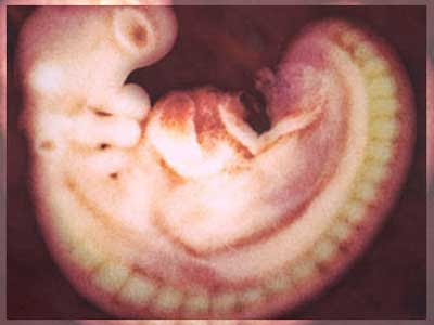 imagen 3d de 4 semanas embarazo