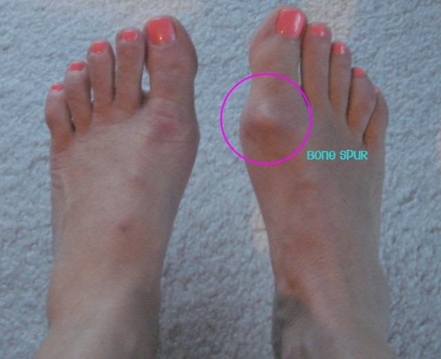 narrow toe box shoes