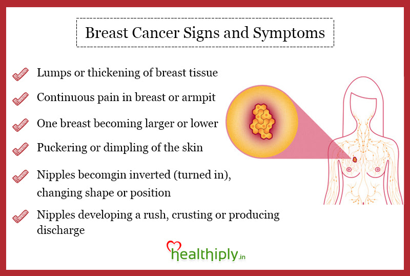 Overview of Breast cancer
