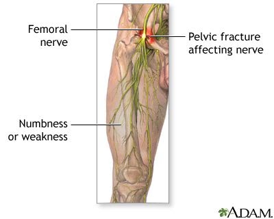 How To Tell If You Have Nerve Damage In Your Leg - PHYQAS