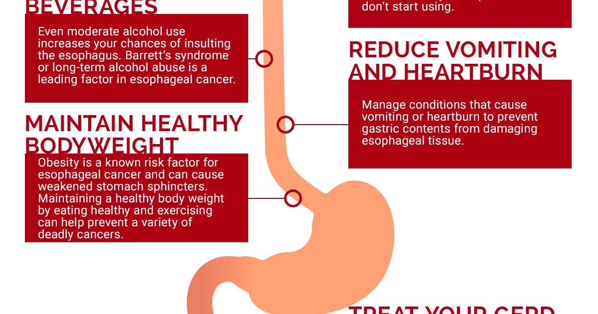 Best Treatment For Esophageal Cancer upthestairsdesigns