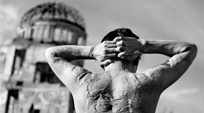Những hình ảnh chết chóc trong thảm họa bom nguyên tử Hiroshima - ảnh 6 Hình ảnh Những hình ảnh chết chóc trong thảm họa bom nguyên tử Hiroshima số 6