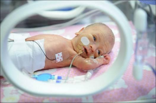 BEBES PREMATUROS: NUTRICIÓN