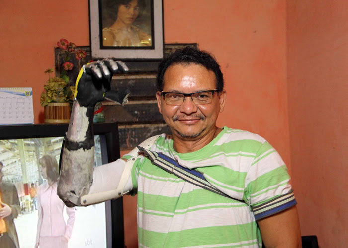 José Arivelton construiu o próprio braço há um ano e dois meses (Foto: Fernanda Moura / Tribuna do Ceará)