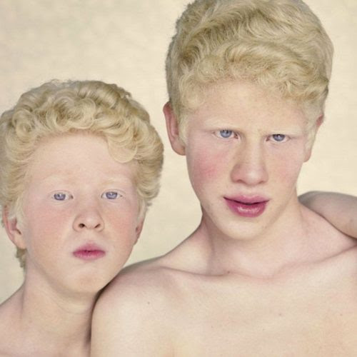 A beleza única dos albinos A beleza única dos albinos