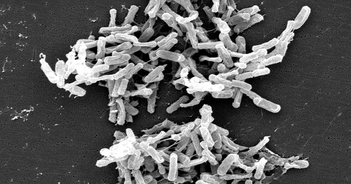 شكل لميكروب كلوستريديوم البوتولينوم تحت الميكروسكوب Asoo