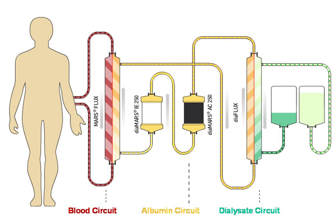 Dialysis device Gambro
