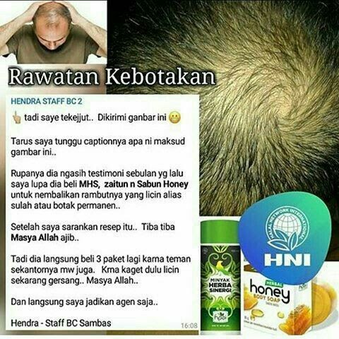 Manfaat Minyak Herba Sinergi Untuk Rambut Botak - MINYAKOL
