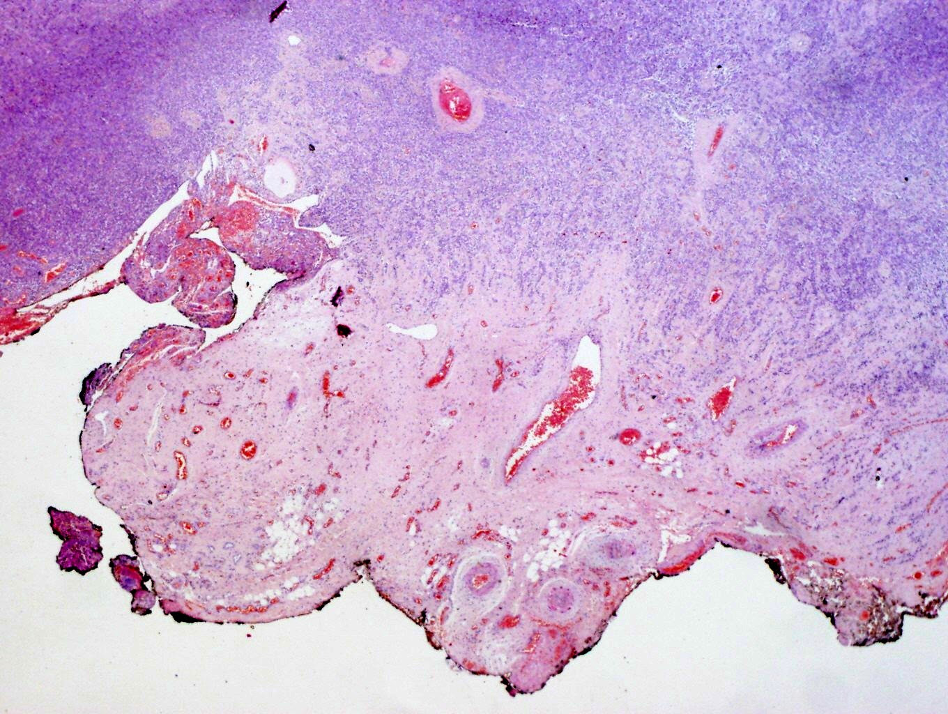 Pleura Pulmonar Histologia Damineh Farooqi 3409