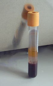 serum blood vacutainer gel after sst meaning centrifugation cells clot lab vials separated activator centrifuge between layer