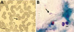 Thumbnail of Babesia microti parasites (arrows) detected in Giemsa-stained thin (A) and thick (B) blood smears from persons living in 2 rural communities, southeastern Bolivia, 2013.
