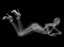 naked xray women