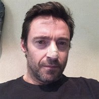 Hugh Jackman: "I have a tumor of the skin"
