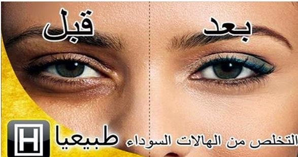 كيفية علاج السواد تحت العينكيفية علاج السواد تحت العين جددي جمالك