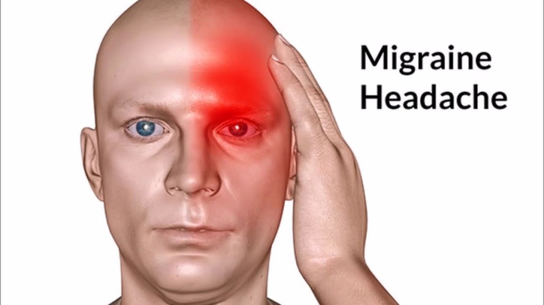 Ubat Migrain Alami  QQ Rumah