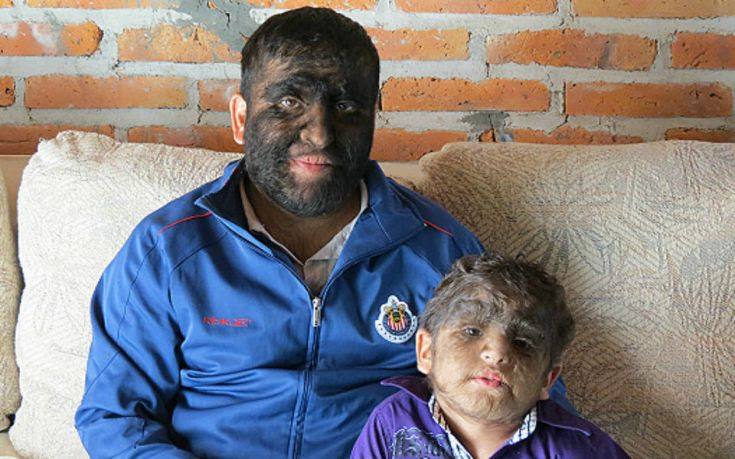 Αποτέλεσμα εικόνας για ανθρωπος λυκανθρωπος