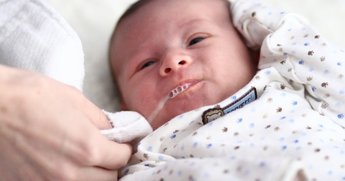 Gerd Symptoms Babies Treatment Gastric Reflux Gerd