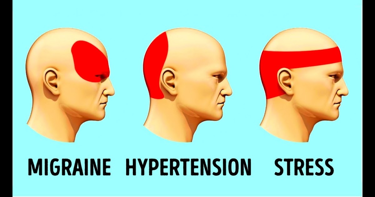 Do Babies Get Headaches whatifideadesign