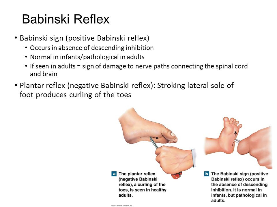 Image result for Normal plantar reflex in adults Below image