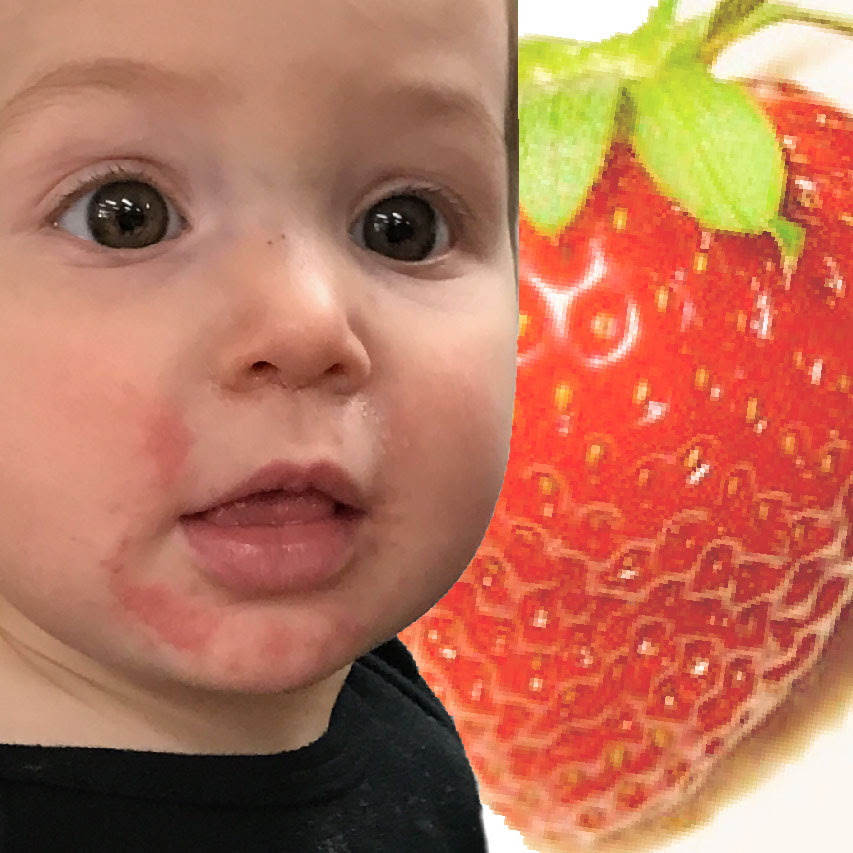Is Your Child Allergic To Strawberries Hint Probably Not