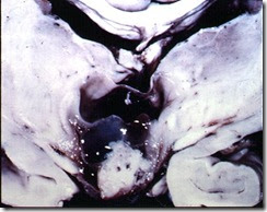 Click to enlarge figure Click to enlarge figure