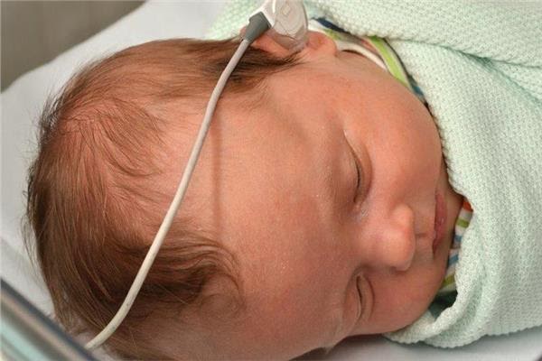 فحص 9100 طفل حديث الولادة ضمن مبادرة السمعيات في المنيا