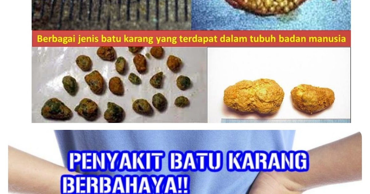 Ubat Tidur Cecair Malaysia Pilihlah